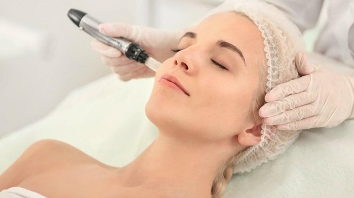 The Secret to Glowing Skin: Top Benefits of Mesotherapy